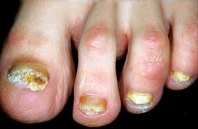 Caracterizarea bolii